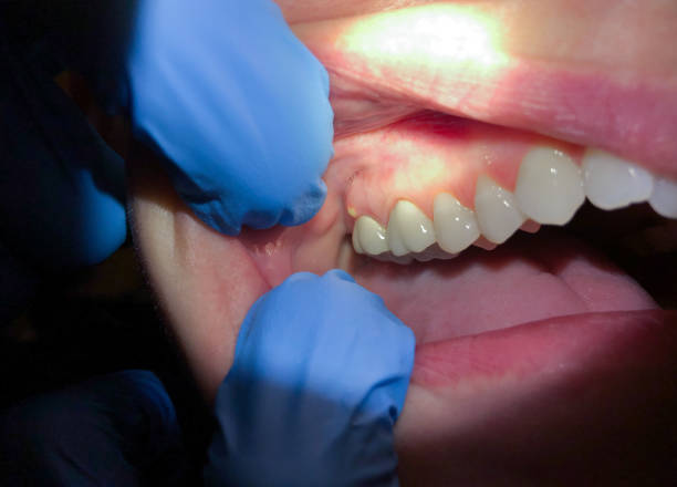 Best Emergency Gum Pain Relief  in Battle Ground, WA